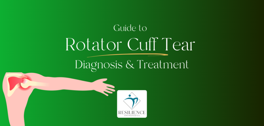 Guide to Rotator Cuff Tear treatment in san jose