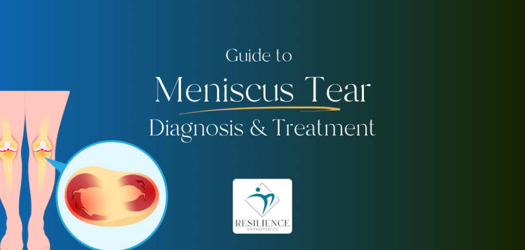 Guide to meniscus tear treatment