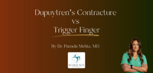 Dupuytren's contracture vs trigger finger